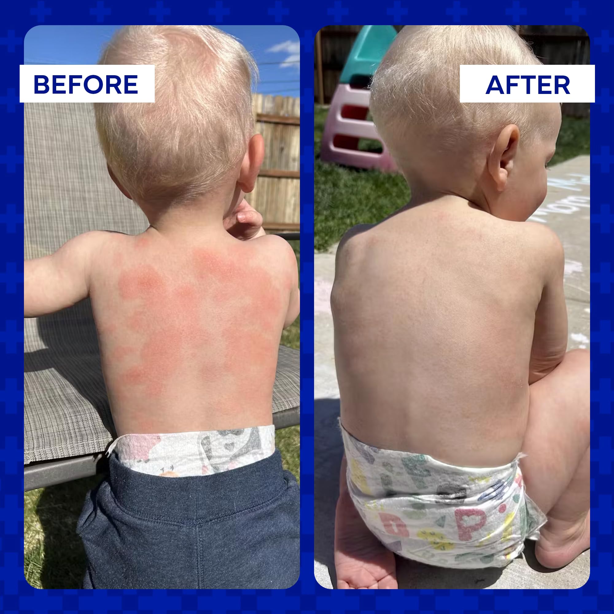 emuaid ointment close-up showing texture of the formula on skin