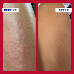 EMUAIDMAX Ointment Vitamin E detail emphasizes moisturizing skin barrier benefits
