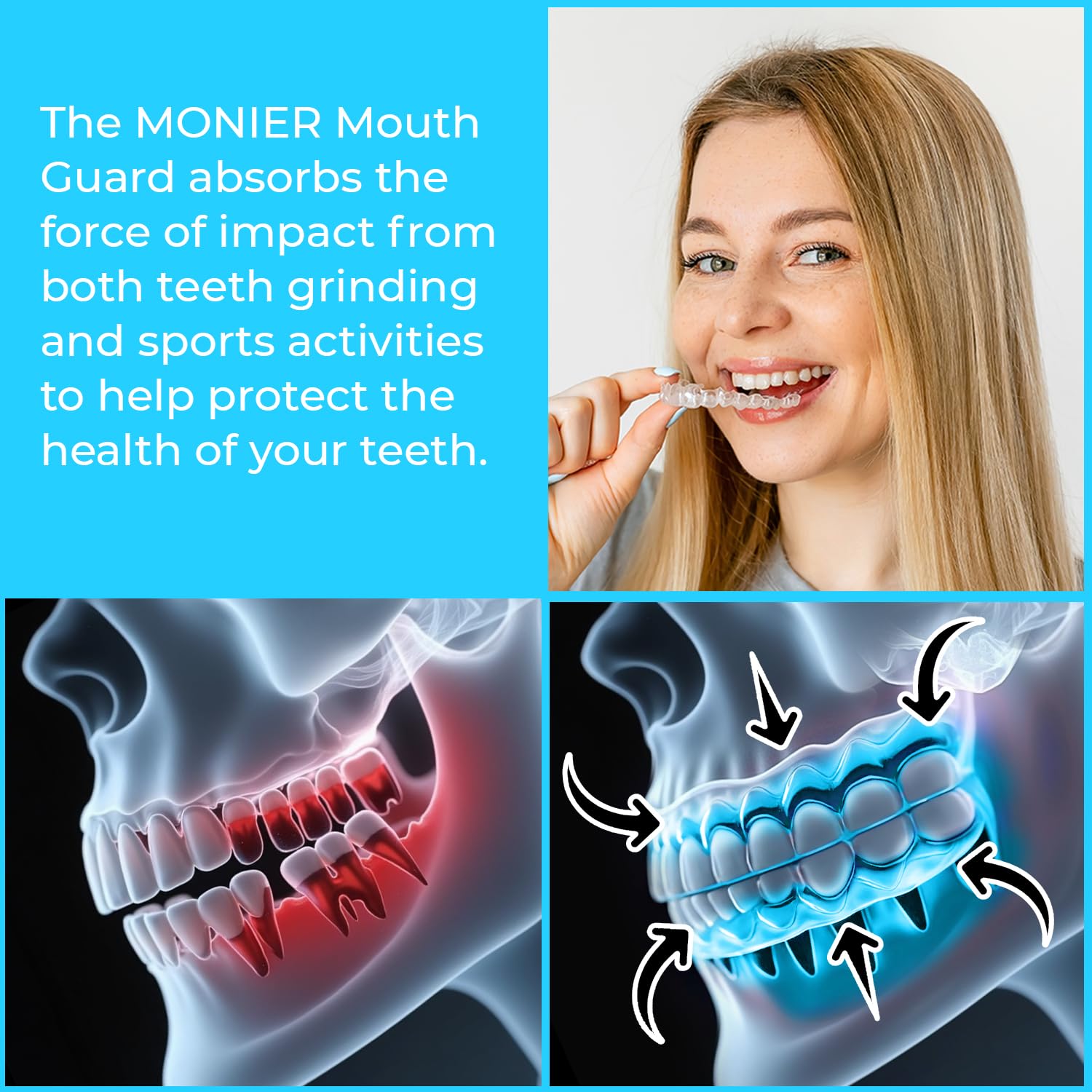 Enamel protection and wear resistance close-up