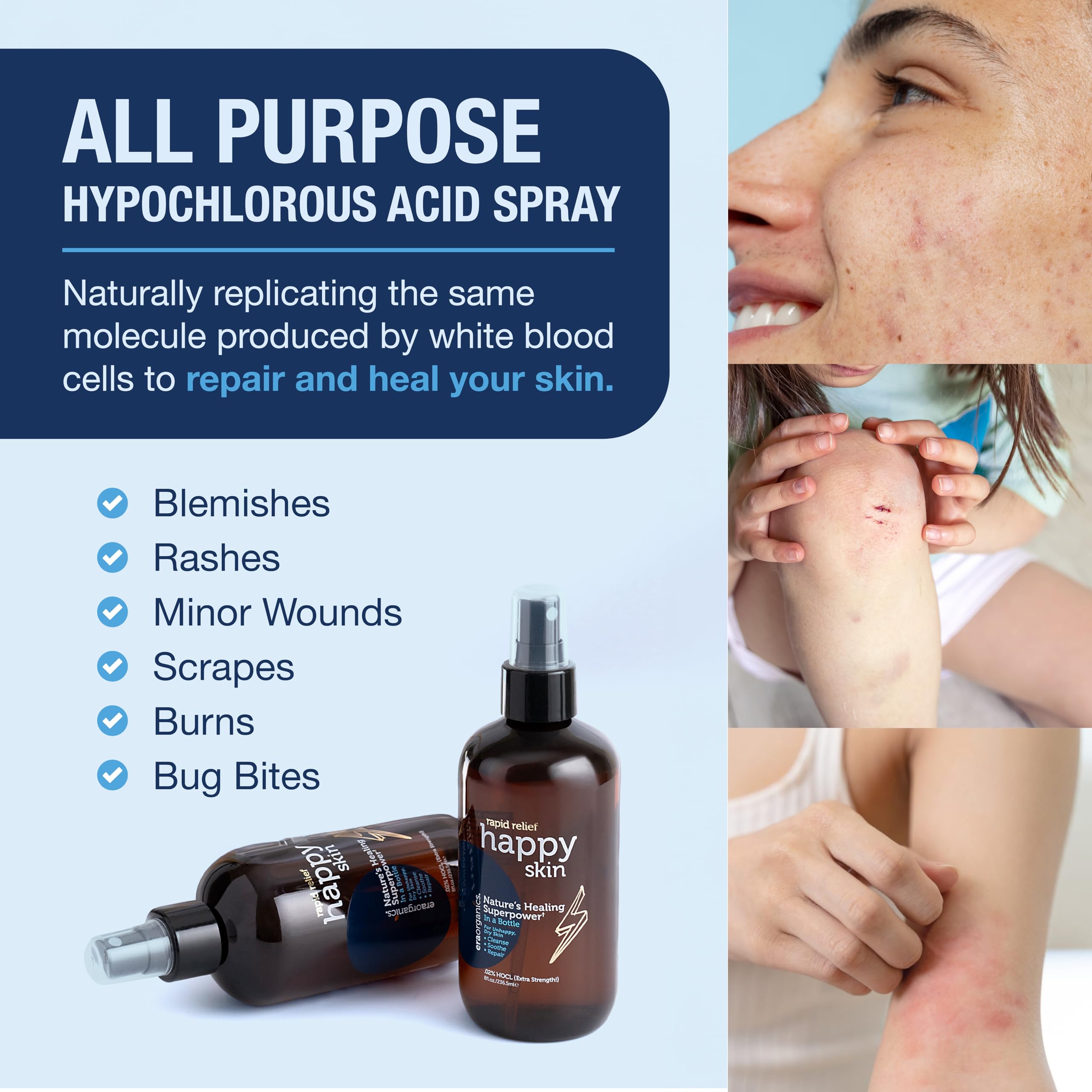 Era Organics HOCl spray for dry skin — hydrates and soothes with a light mist.