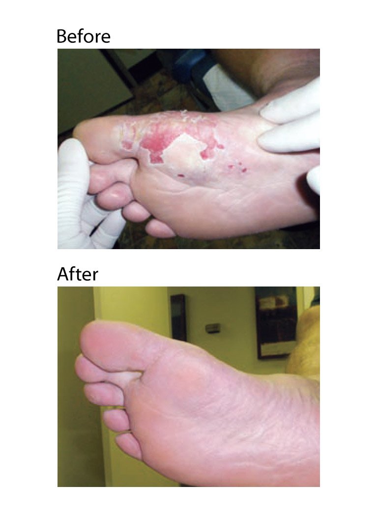 Eras Natural Sciences Wound Honey with Aloe and Panthenol ready for soothing application