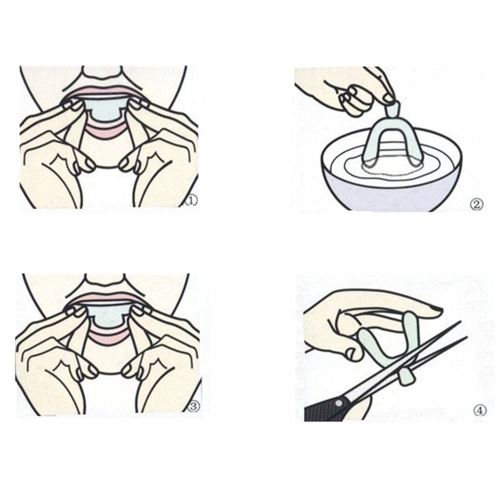 Close-up of transparent, smooth whitening tray material