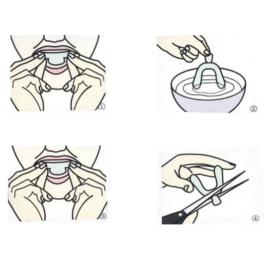 Close-up of transparent, smooth whitening tray material