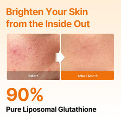 ESTHER FORMULA liposomal strip ingredients: glutathione, L-Cysteine, milk thistle.