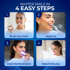 Professional-grade whitening gel ingredients labeled