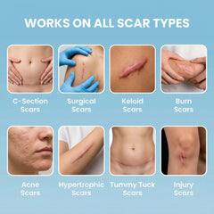 Eva Naturals silicone scar tape unrolled strip demonstrates easy adhesion for sensitive skin