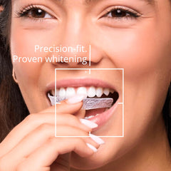 Full-arch whitening showing trays covering front, sides, and between teeth