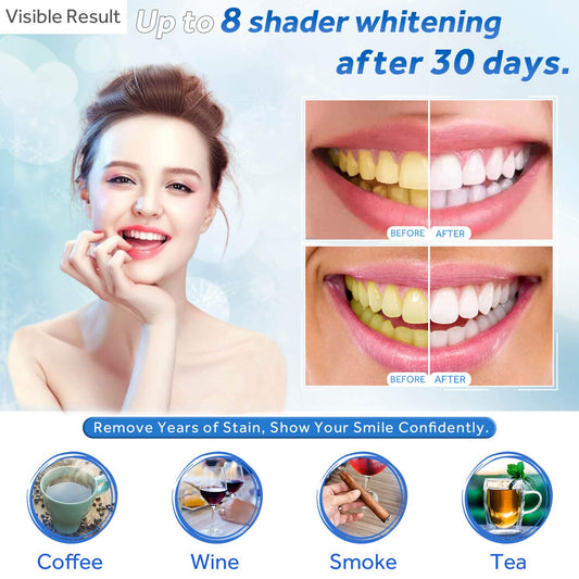 Close-up of EZGO whitening gel tubes showing 22% carbamide peroxide
