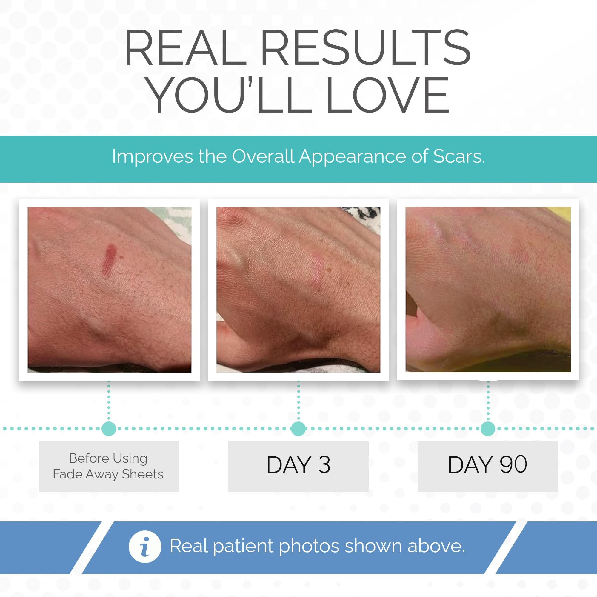Fade Away silicone scar sheets cut-to-size close-up enables precise scar coverage