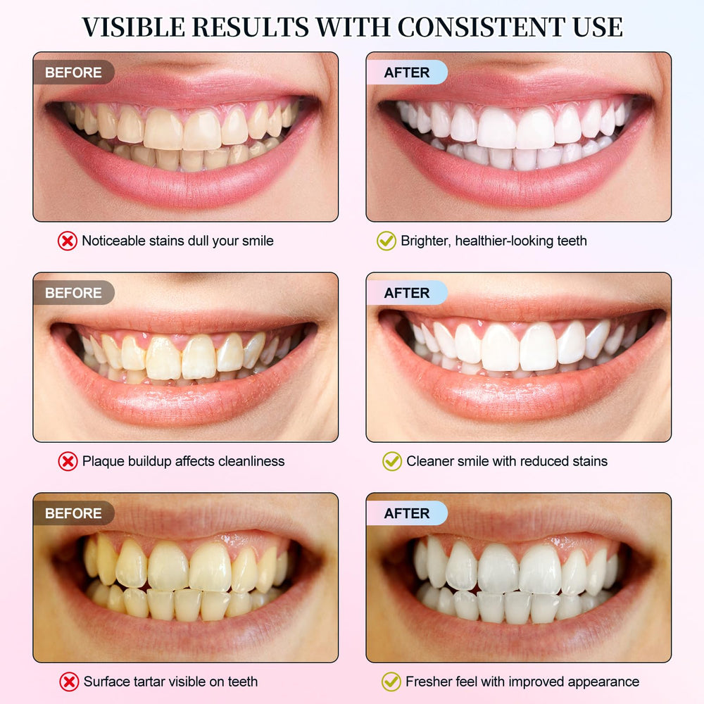 Family-friendly Niacinamide whitening toothpaste for all ages