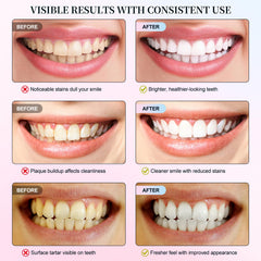 Family-friendly Niacinamide whitening toothpaste for all ages