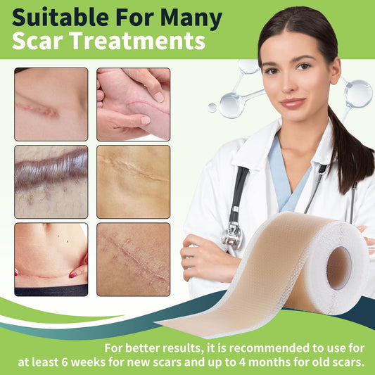 FANPARE scar tape on skin provides comfortable, discreet scar coverage