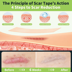 Close-up of FANPARE silicone scar tape texture showing skin-friendly material