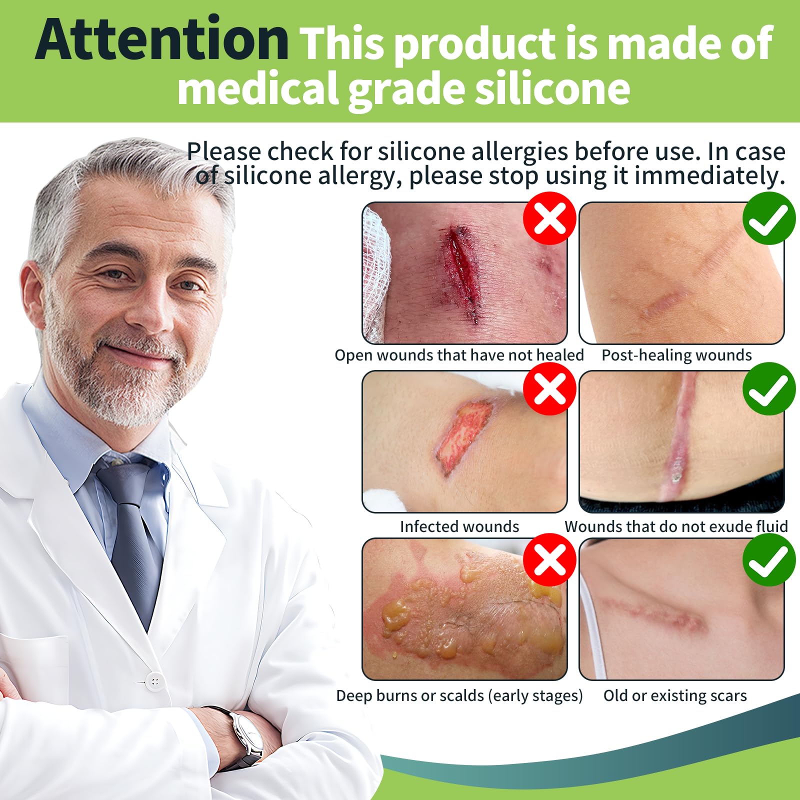 FANPARE silicone scar tape trimmed to fit curved scar contours
