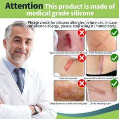 FANPARE silicone scar tape trimmed to fit curved scar contours