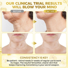 FeeMeFee anti-aging retinol application closeup highlighting gentle use.