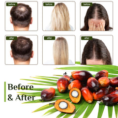 FEIBTH Batana Oil nourishes thicker-looking strands with deep conditioning