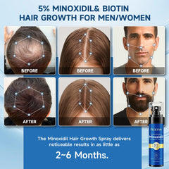 Felicemy Minoxidil scalp close-up showing follicle activation potential