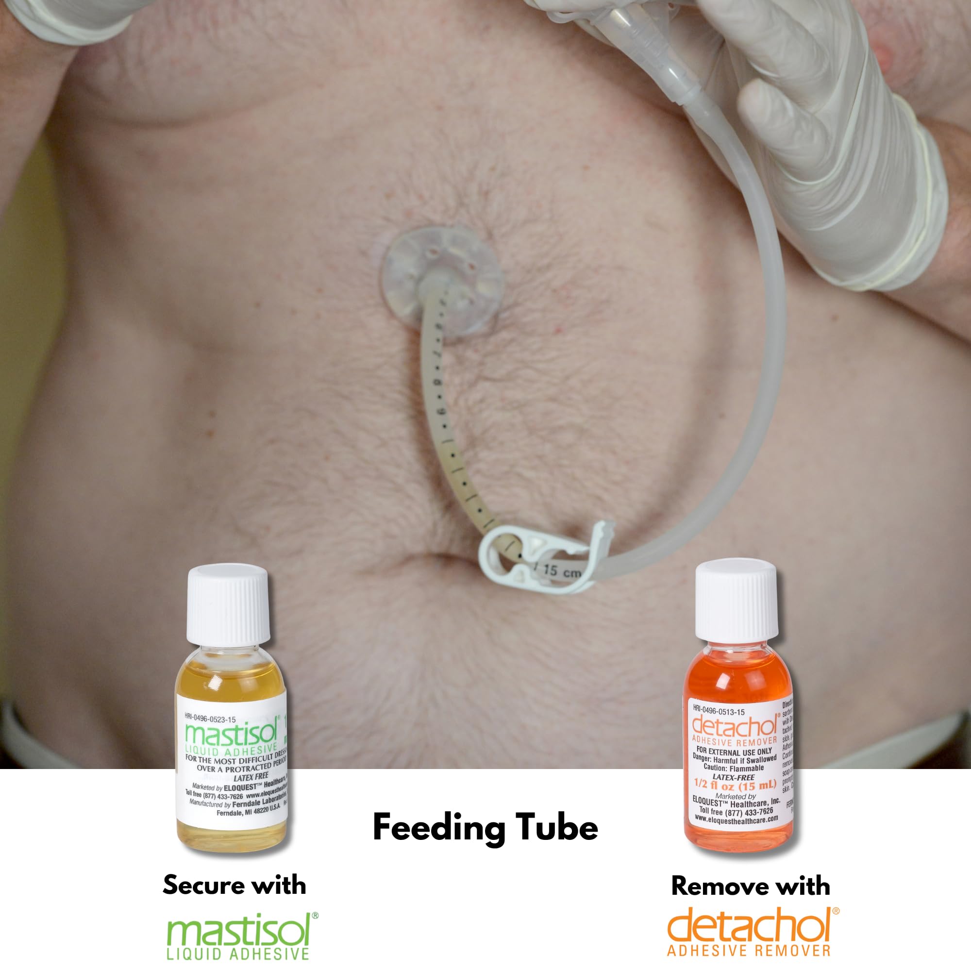 Ferndale Detachol in use while removing a bandage and adhesive residue