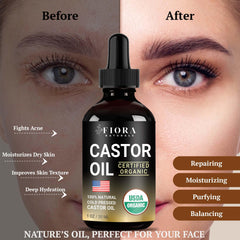 Fiora Naturals castor oil for hair growth, nourishes strands and promotes shine.