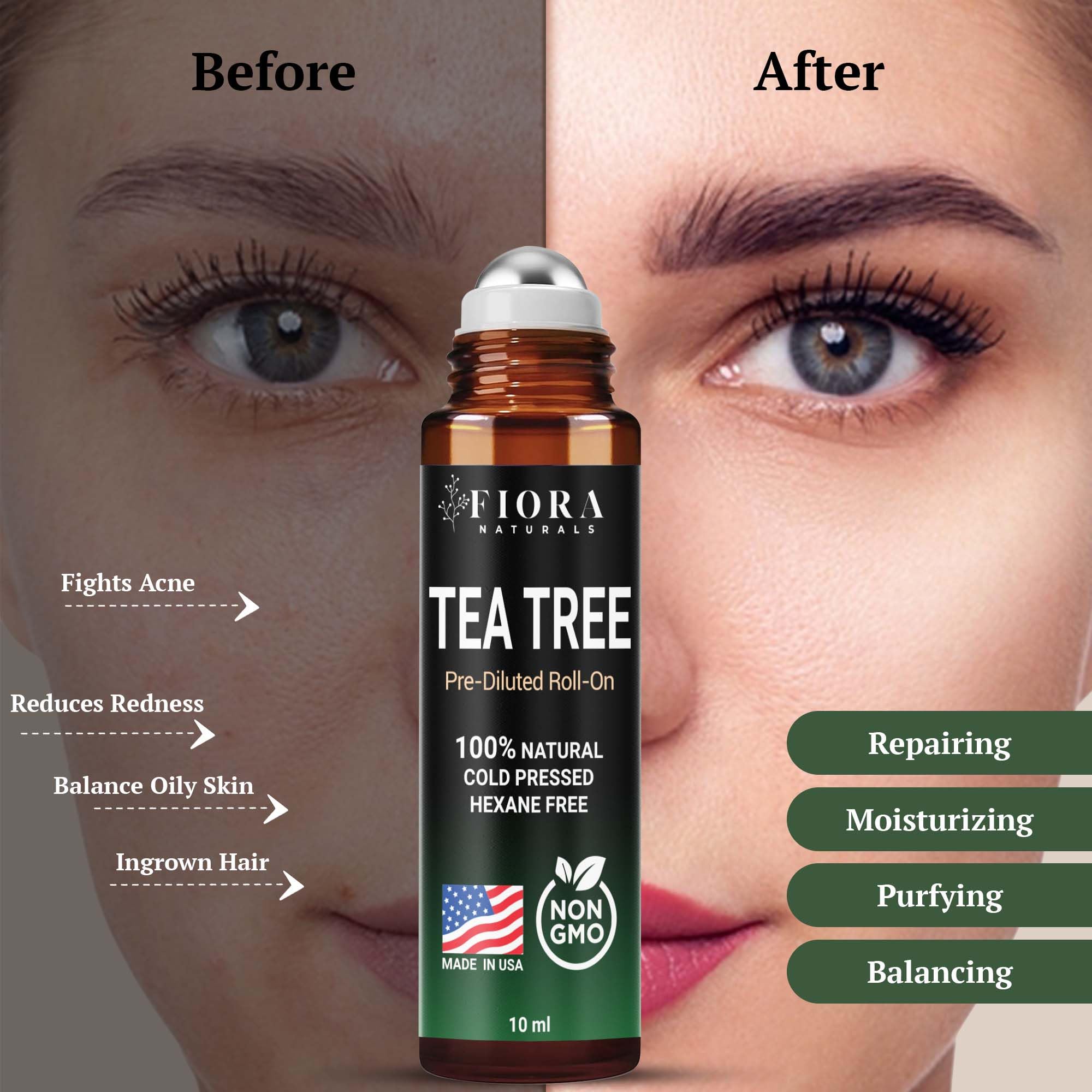 Roll-On applied to skin for blemish care and clarity