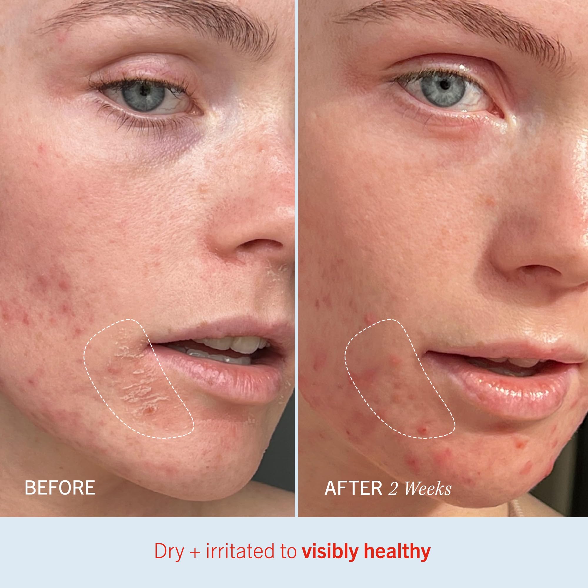 Utilisation visage et corps pour hydratation quotidienne avec Ultra Repair Cream.