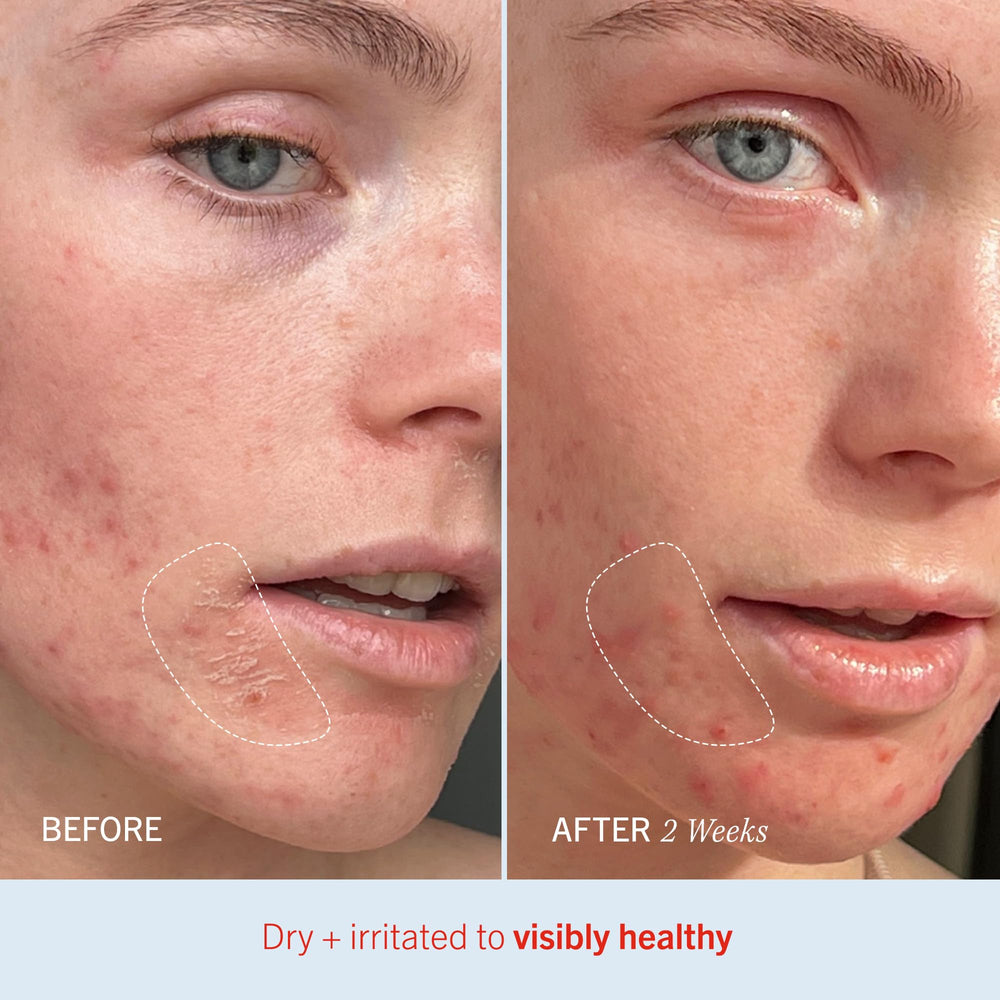 Utilisation visage et corps pour hydratation quotidienne avec Ultra Repair Cream.