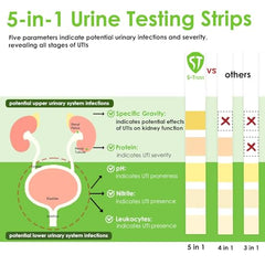 Illustration of 5-in-1 test strip results and color chart