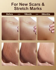 Flowhyet Vitamin E Oil for stretch marks supports smoother-looking skin.