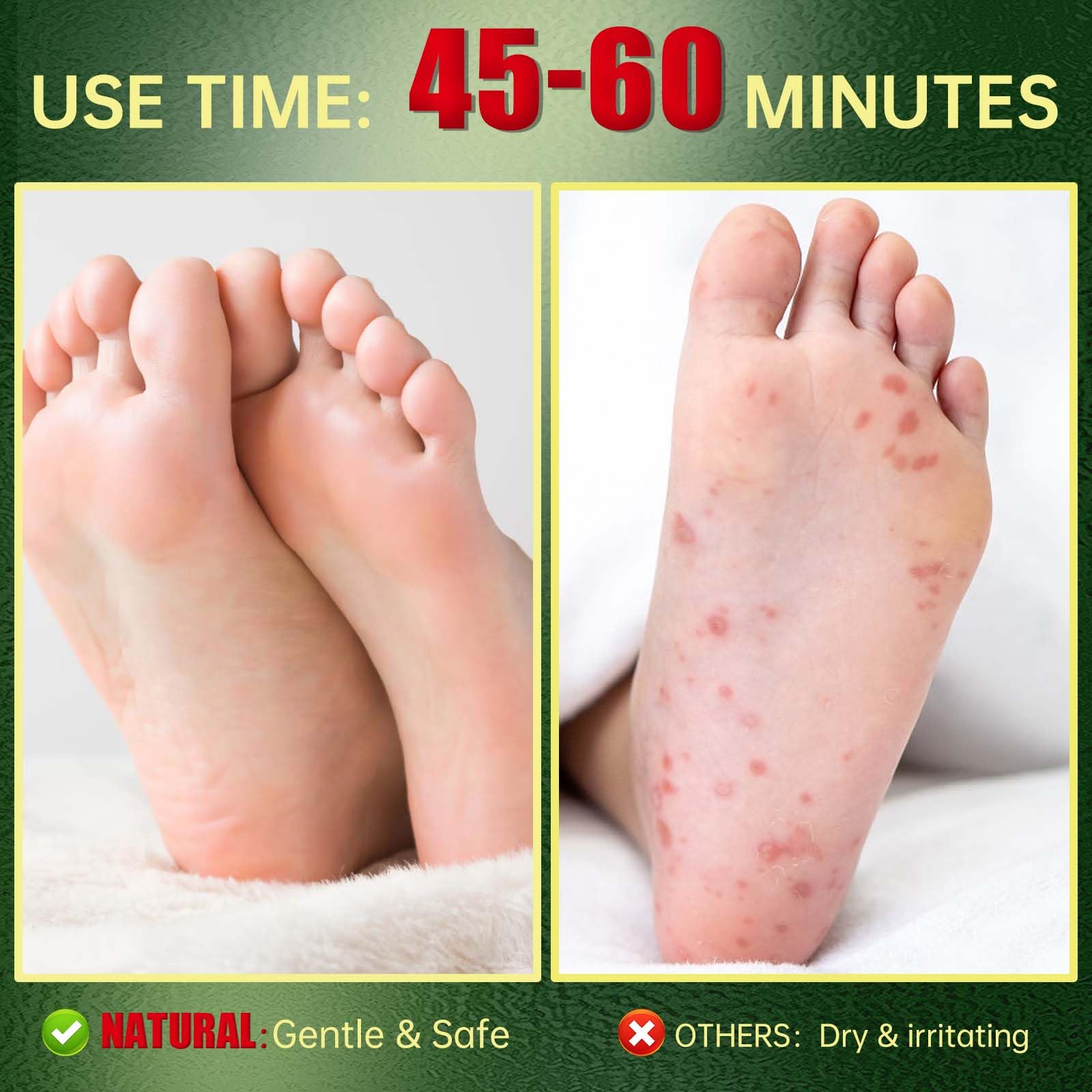 FLYLEAF Foot Peeling Mask natural extracts with cucumber for nourishing care.