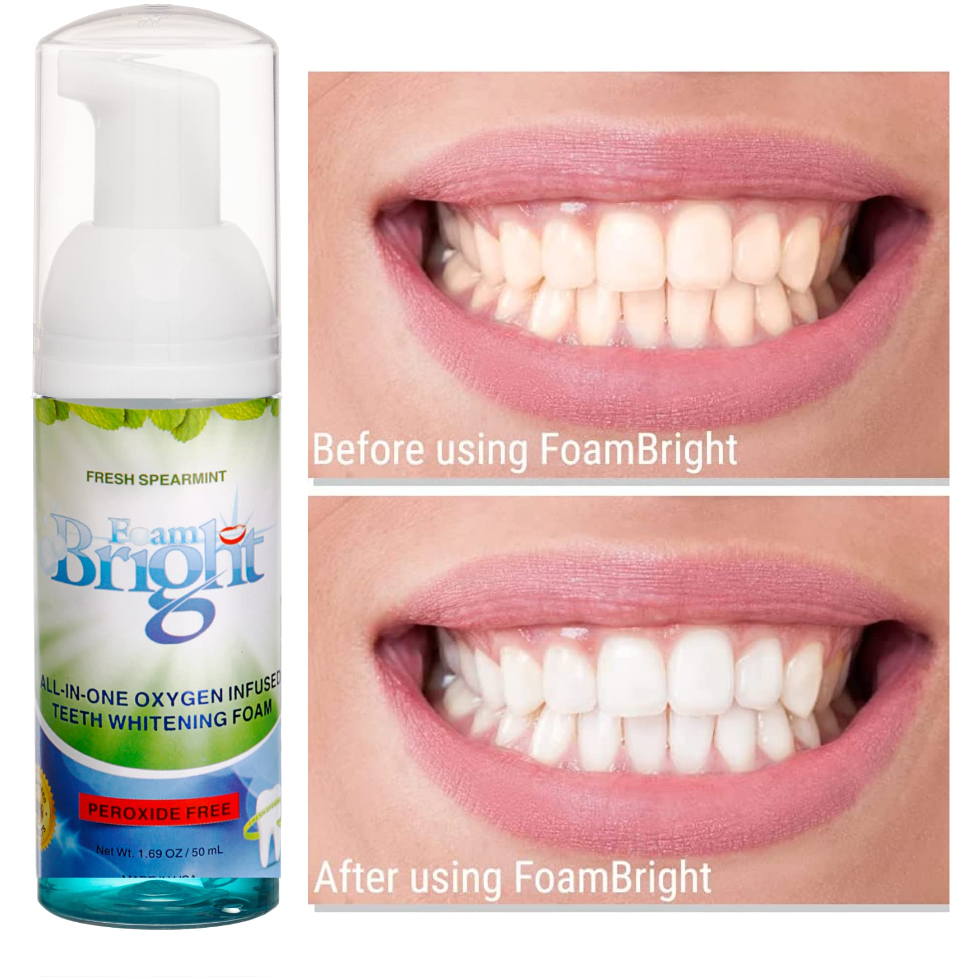 Mouthguard and dental appliances cleaned with FoamBright