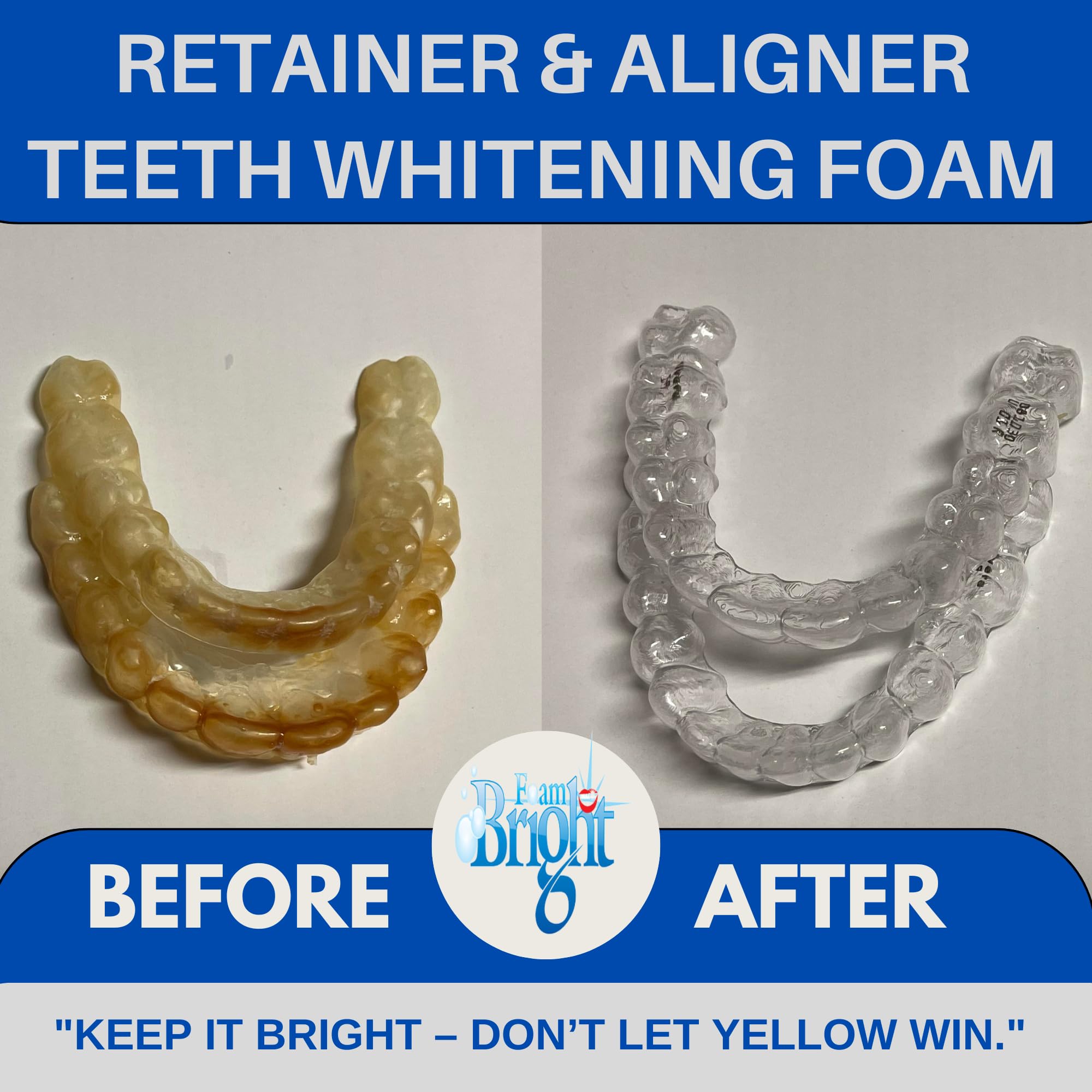 Teeth whitening foam penetrating between teeth for cleaning and whitening
