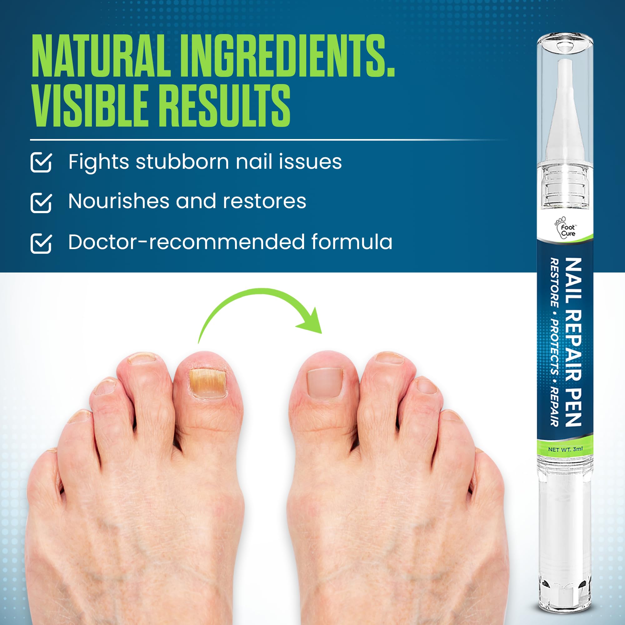 Foot Cure Nail Repair Pen oregano oil highlight signals botanical support for nails.