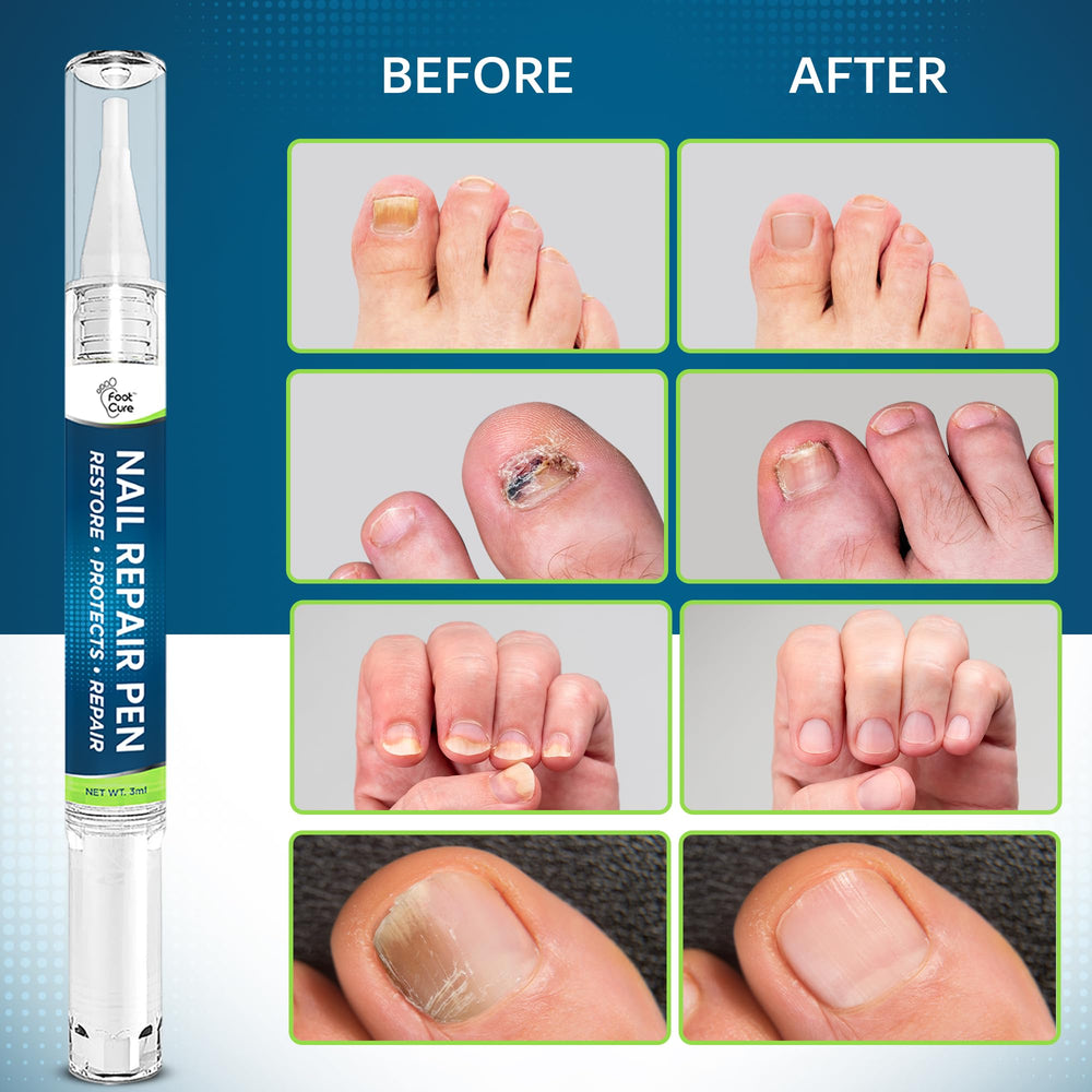 Foot Cure Nail Repair Pen tea tree oil inset illustrates natural ingredients.