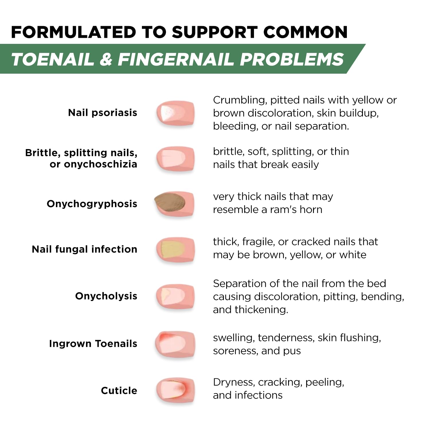 Foot Cure toenail fungus-treatment-packaging-made-in-usa product box signals quality.