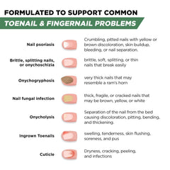 Foot Cure toenail fungus-treatment-packaging-made-in-usa product box signals quality.