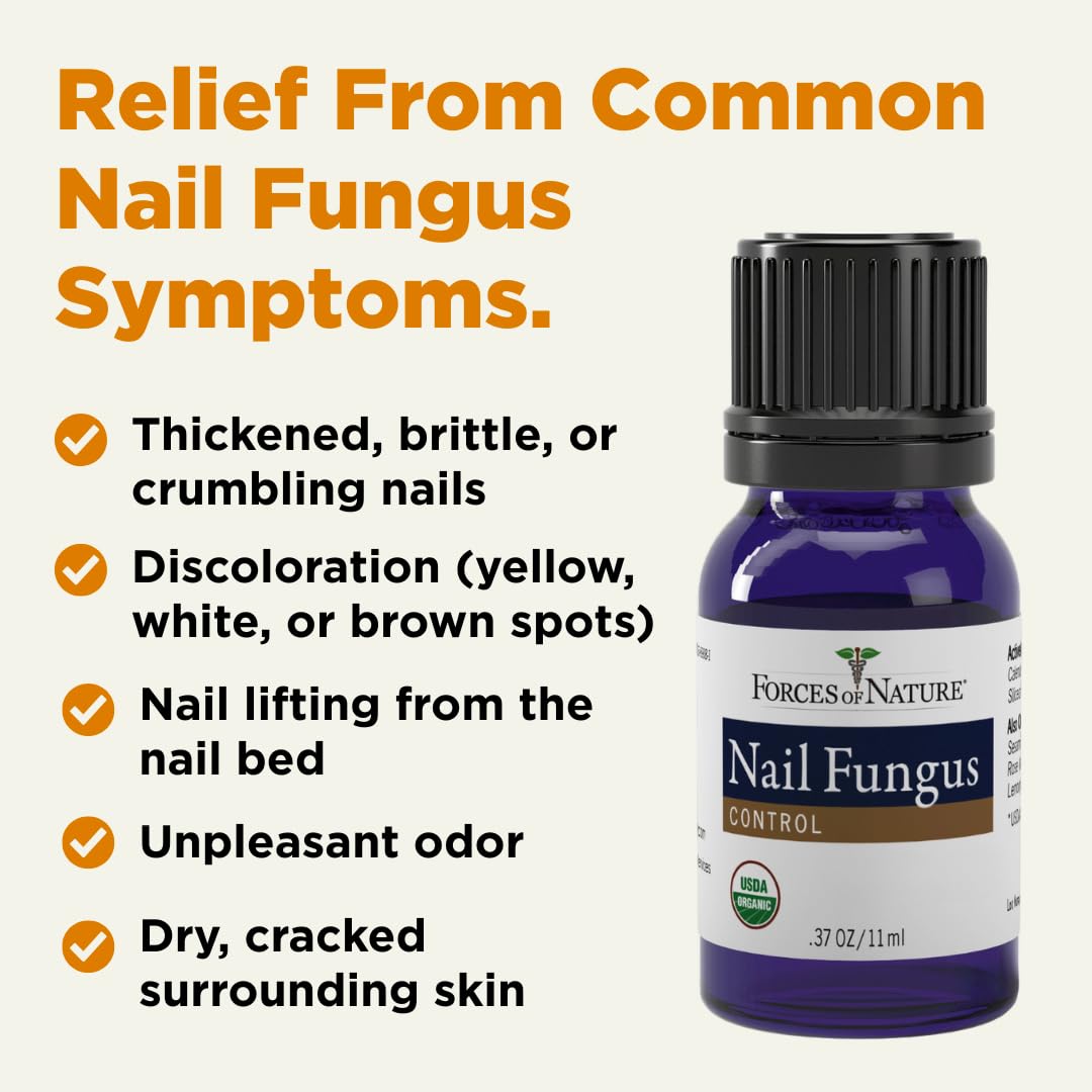 Forces of Nature toenail treatment calendula close-up highlighting soothing healing for damaged nails.