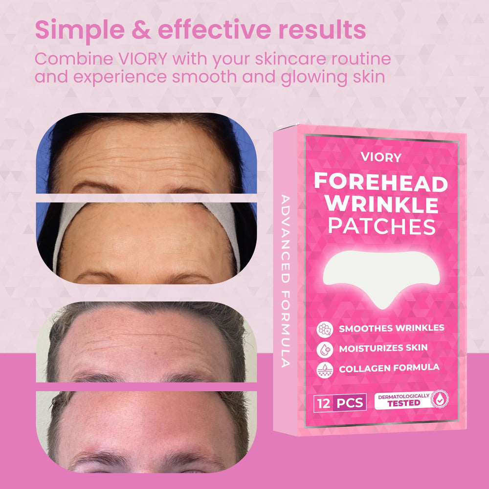 Before and after effects of Forehead Wrinkle Patches