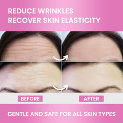 12-piece Forehead Wrinkle Patches pack
