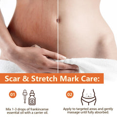 Facial care setup with frankincense essential oil