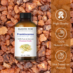 Amber glass Frankincense essential oil bottle with built-in dropper