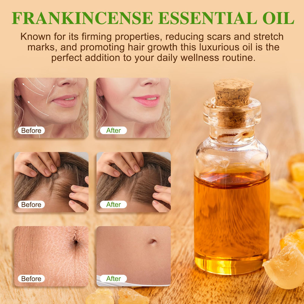 Frankincense essential oil for face, wrinkles, and scars