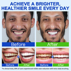 Fresh breath hydroxyapatite toothpaste