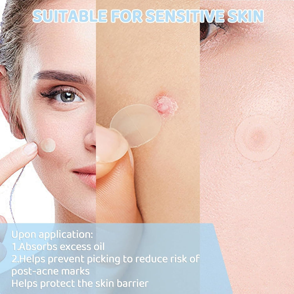 Large 104-count FUANKANG pack ideal for restocking your patch kit.