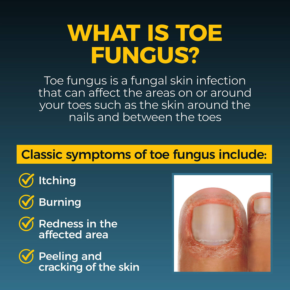 Fungi-Nail Pen Applicator infusion of five essential oils offering soothing skin care around nails.