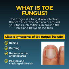 Fungi-Nail Pen Applicator infusion of five essential oils offering soothing skin care around nails.