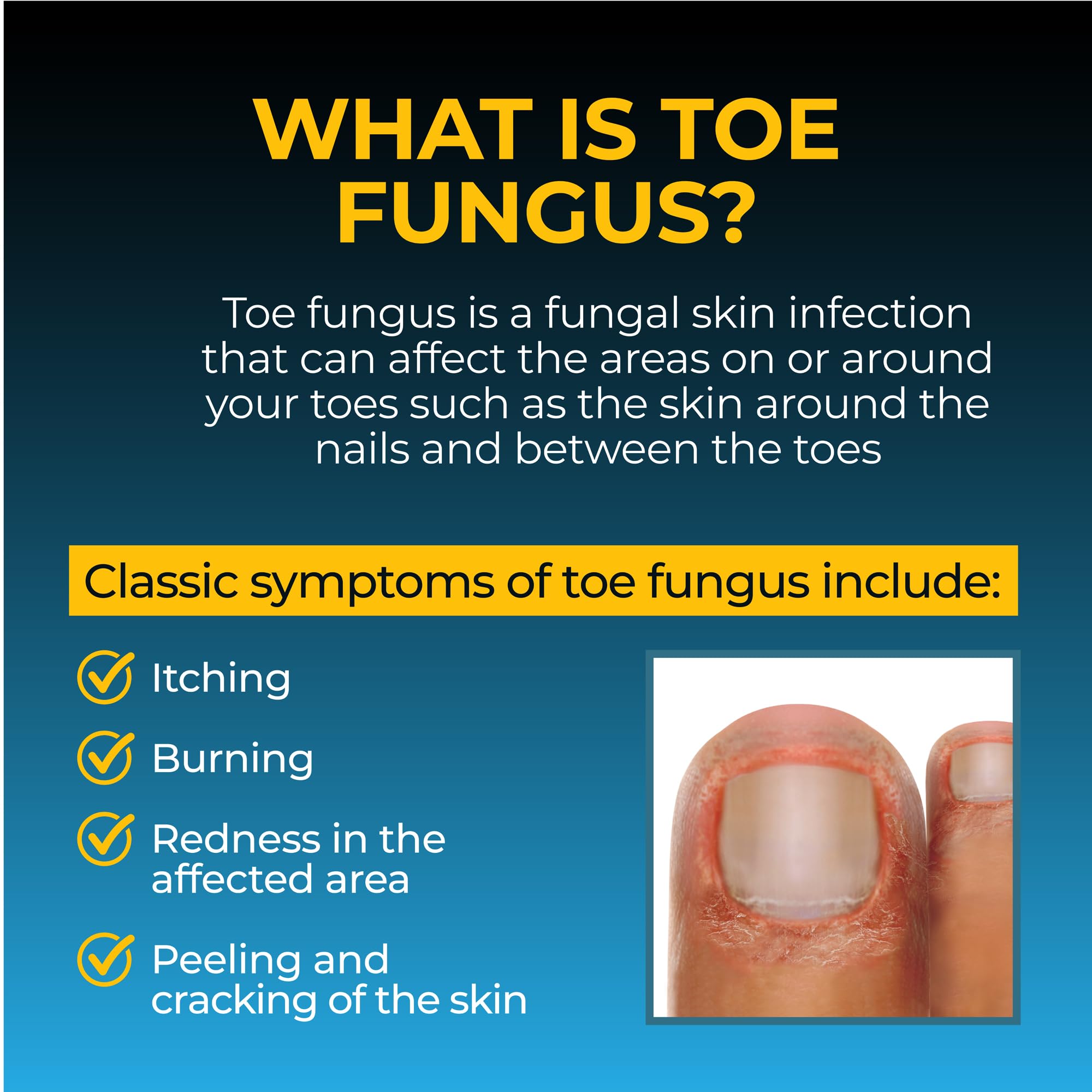 Fungi-Nail Pen Applicator small size in hand demonstrating travel-friendly antifungal care.