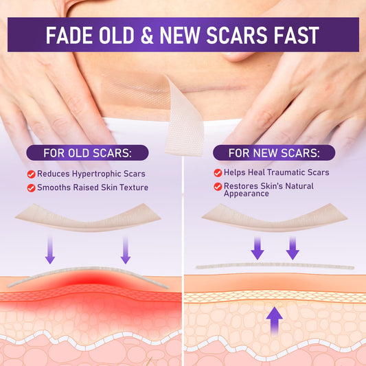 GEIMIY scar tape close-up, soft silicone for skin-friendly scar care.