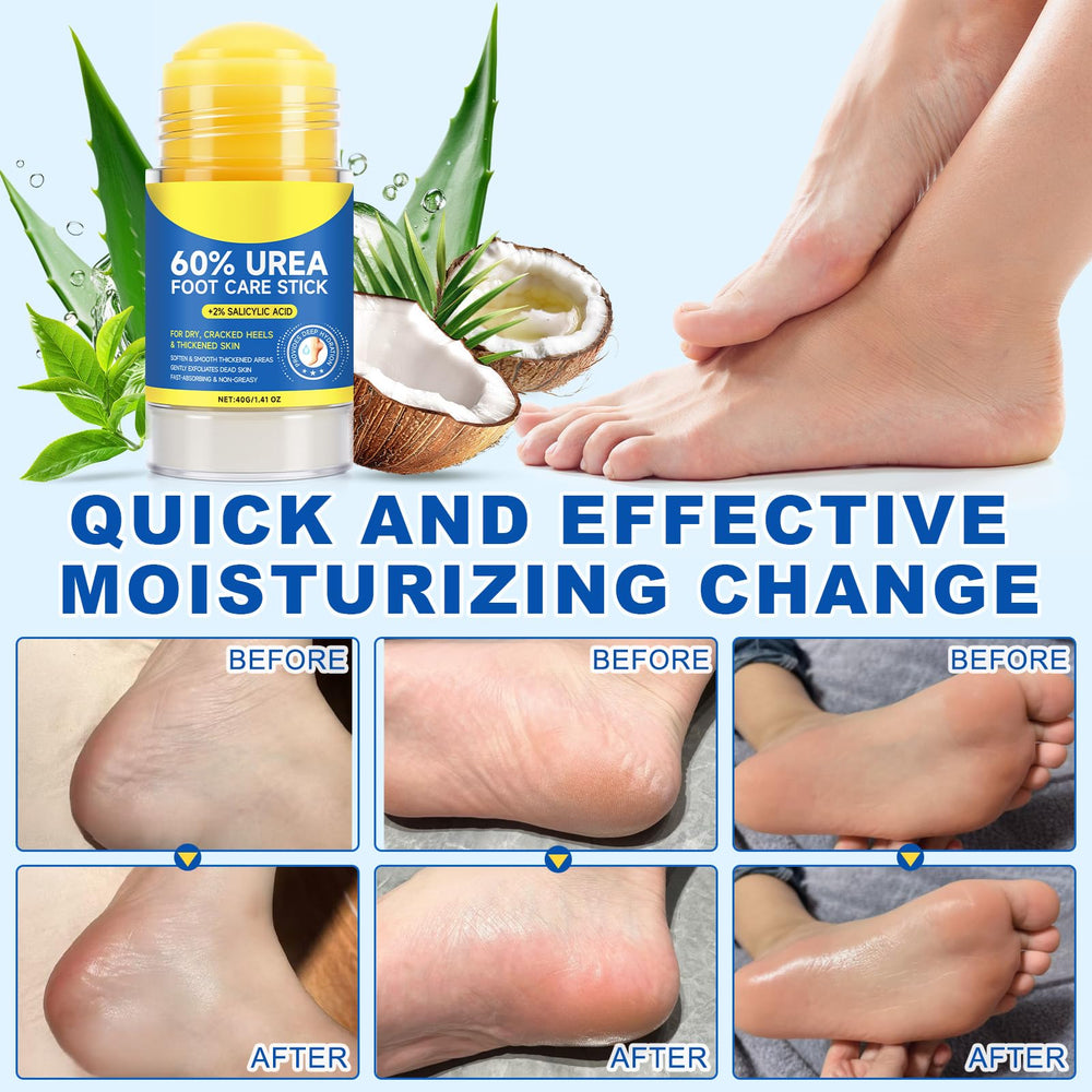 Very dry skin example benefits from Generic Urea 60% Cream Stick