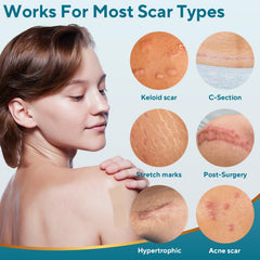 GIATENL silicone scar sheets close-up showing thin, breathable material for daily use.